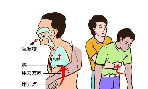 如何实施海姆急救法对宠物进行急救（以狗狗为例，掌握正确的海姆急救法）