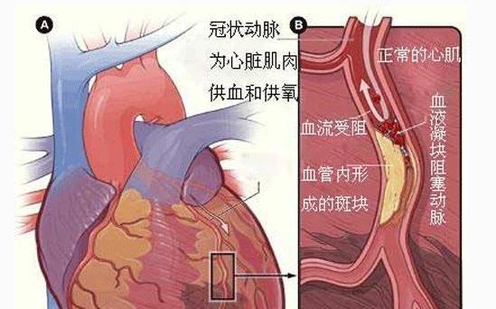 狗狗胃穿孔的症状及处理方法（宠物狗胃穿孔的常见表现及处理措施）