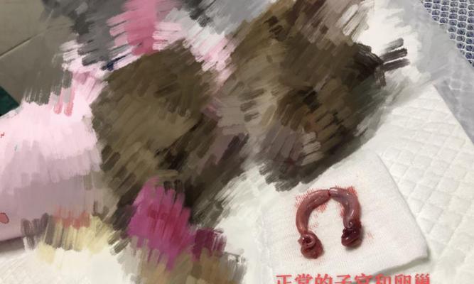 猫去势手术的重要性与好处（宠物医学关键手术——猫去势手术详解）