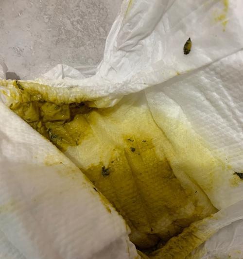 肚子有虫是什么症状？（了解肚子有虫的主要特征及治疗方法）