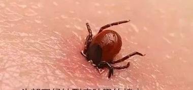 被蜱虫咬了怎么办？专家推荐的药物治疗方法（预防蜱虫传染疾病的关键措施以及药物治疗的选择）