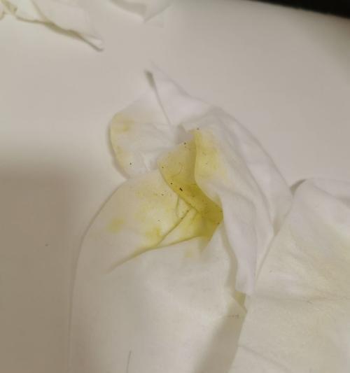 泰迪犬吃什么吐？（了解泰迪犬饮食健康的关键）