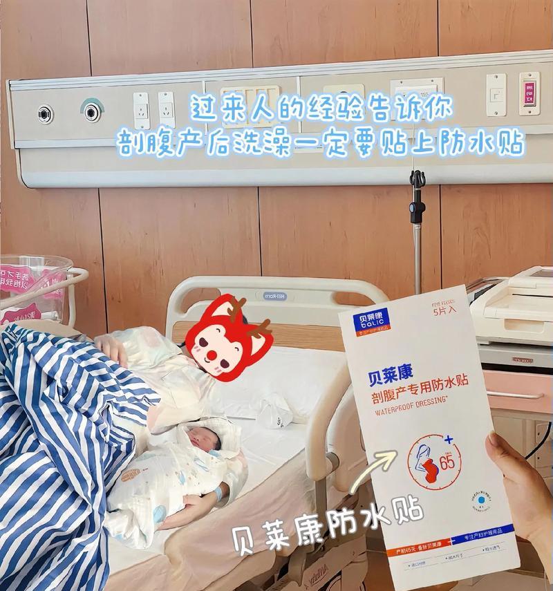 狗剖腹产后多久可以洗澡？（了解合适的洗澡时间能够保护狗狗的健康）