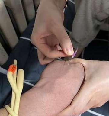 自我给自己打针的正确方法（安全、简便的自我注射技巧与注意事项）